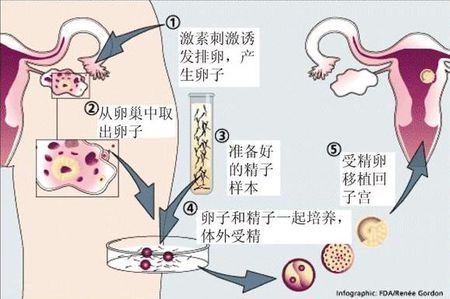 42岁高龄成功案例